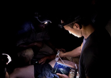 (Simulated For Training) Sonogram in the field