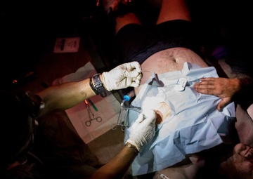 (Simulated for Training) Medical Procedure