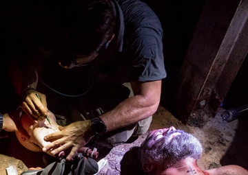 (Simulated for training) Tracheotomy