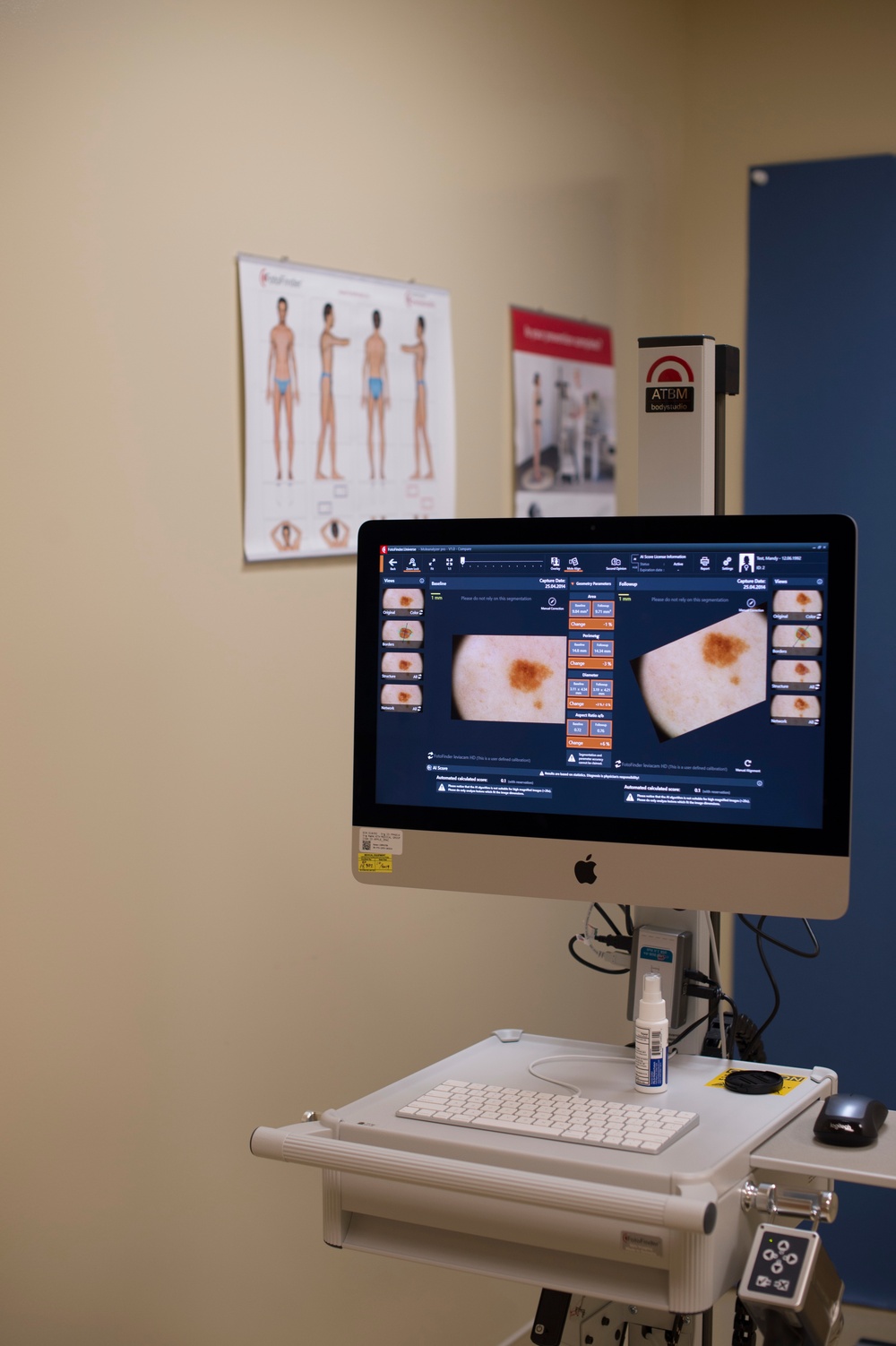 Artificial intelligence makes its way to MacDill dermatology clinic