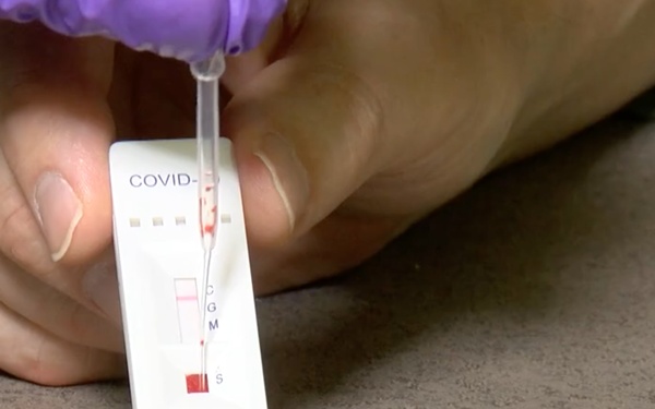 COVID-19 IgG/IgM Antibody Test