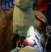 MWD root canal
