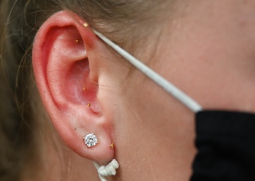 CJTF-HOA surgeon trains Soldiers on Battlefield Acupuncture