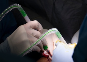 NMCSD’s Plastic Surgery Department Perform Procedure