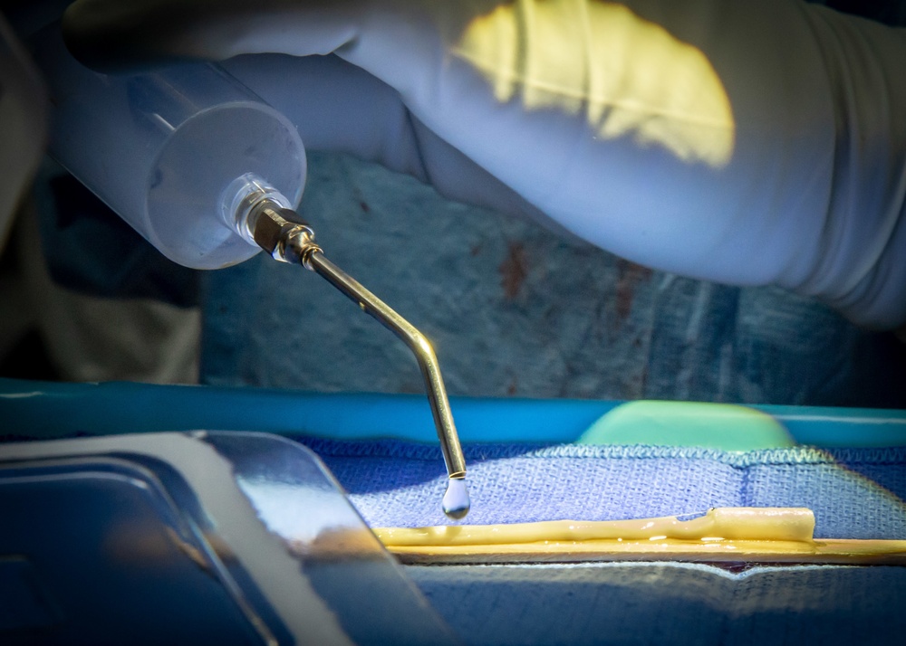 NMCSD Surgeon Performs Nerve Allograft During Immediate Jaw Replacement Procedure