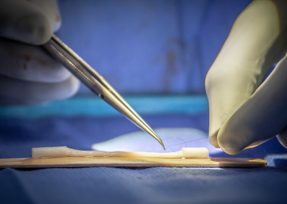 NMCSD Surgeon Performs Nerve Allograft During Immediate Jaw Replacement Procedure