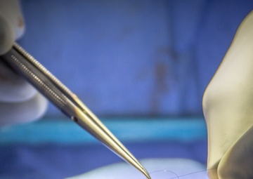 NMCSD Surgeon Performs Nerve Allograft During Immediate Jaw Replacement Procedure
