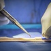 NMCSD Surgeon Performs Nerve Allograft During Immediate Jaw Replacement Procedure