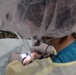 Dental exam