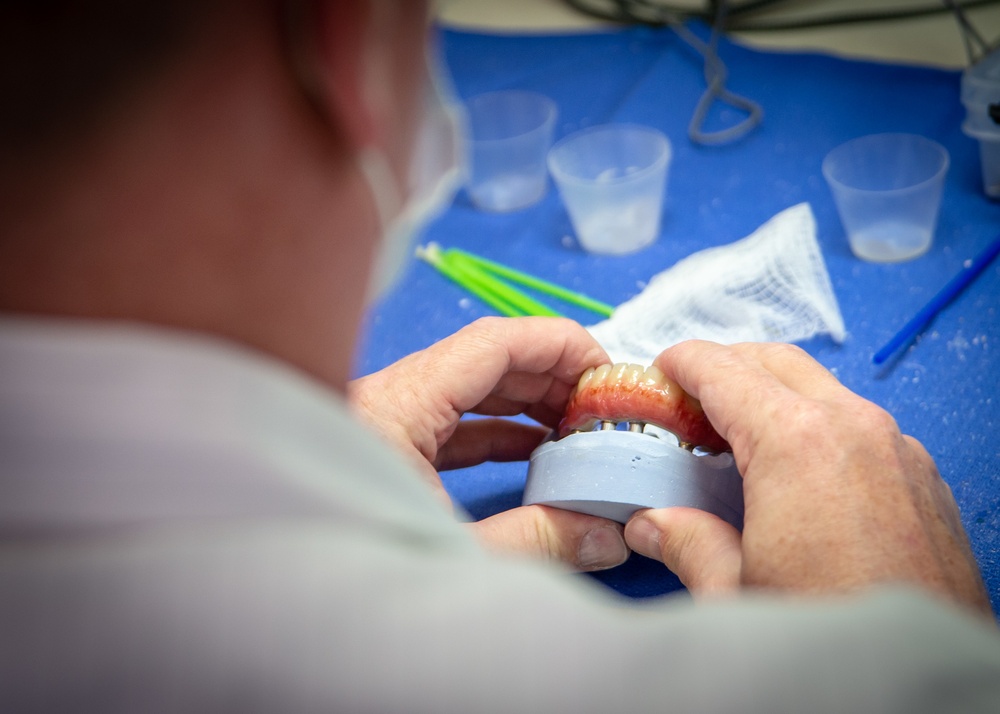 NMCSD Surgeons fit DOD’s, Calif.’s First Ever Immediate Jaw Reconstruction with 3D-printed Teeth Patient with Prosthesis