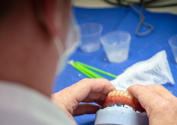 NMCSD Surgeons fit DOD’s, Calif.’s First Ever Immediate Jaw Reconstruction with 3D-printed Teeth Patient with Prosthesis