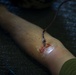 US Marines and Sailors conduct a live fresh old blood transfusion demonstration