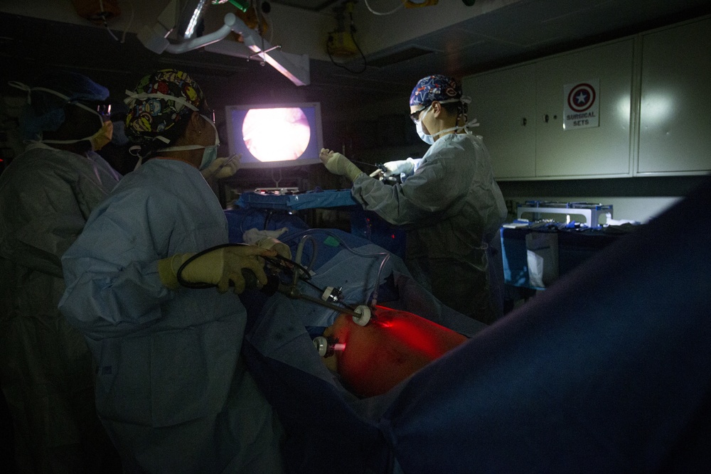 Surgical team conducts a laparoscopic appendectomy