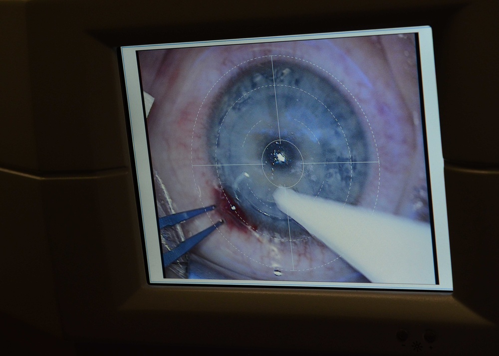 Eye care for 10th Medical Group patients expands with a ‘smile’