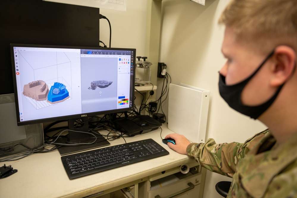 Nailing first impressions: Digital scanner to 3D printer