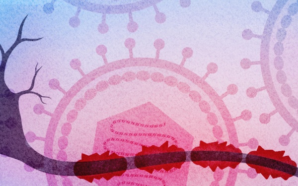 Study Identifies Epstein-Barr Virus Infection as a Leading Cause of Multiple Sclerosis