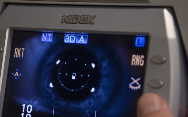 Protecting the eyes of the sky