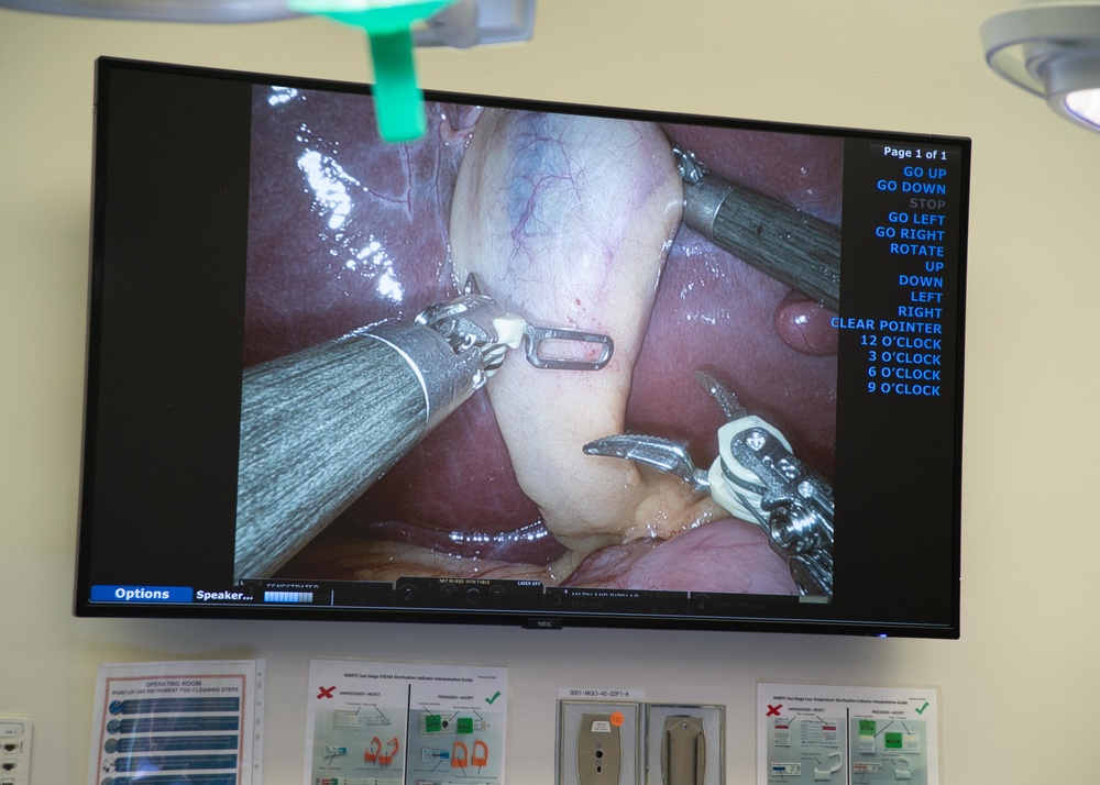 NMCSD San Diego’s First Surgical Telementoring Surgery with NHCP