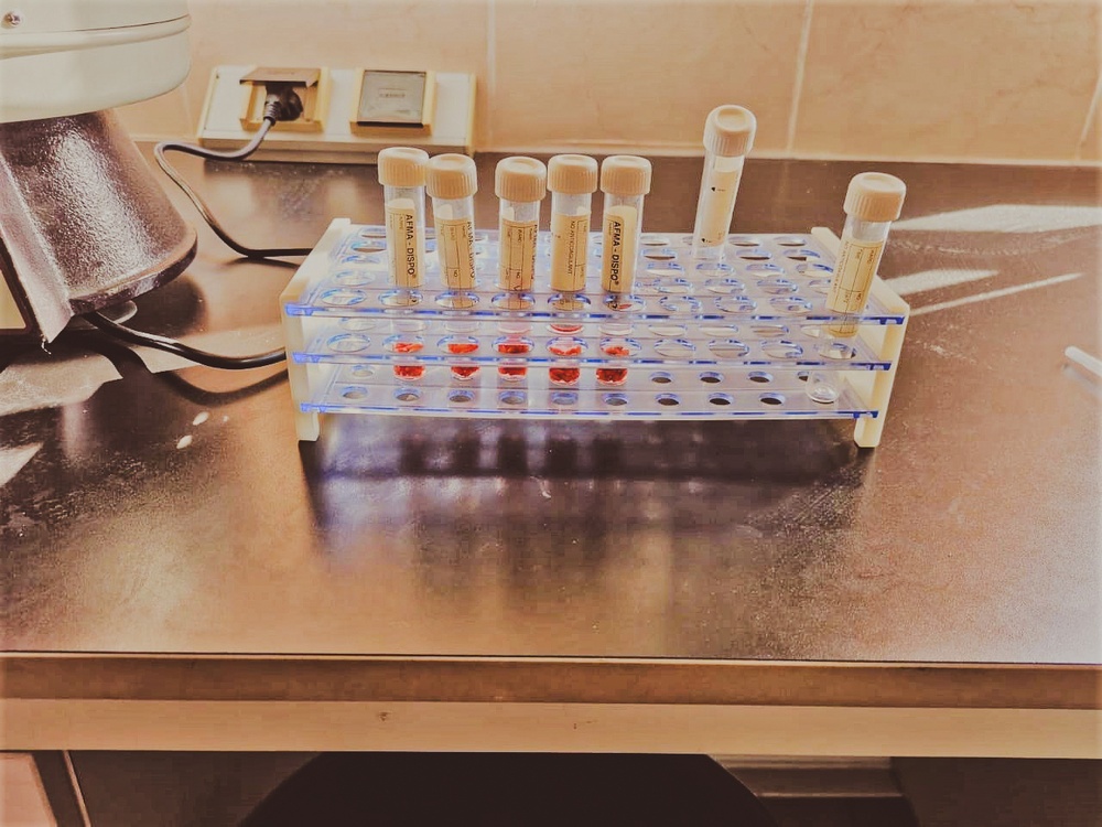 Testing wheat seeds in test tubes to verify their quality before distribution.