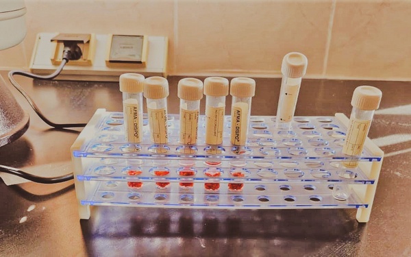 Testing wheat seeds in test tubes to verify their quality before distribution.