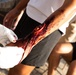 Civilian role players receive simulated injuries before seeking medical attention