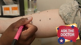 Ask the Doc: Can I Develop Sudden Food Allergies?