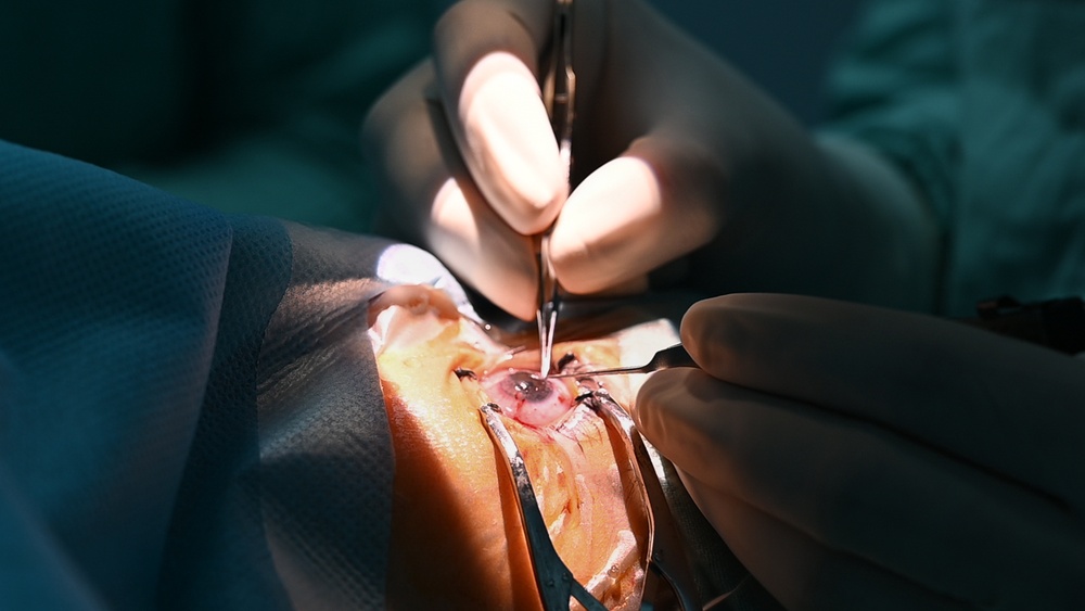 During HEART 22 U.S. and Guatemalan Ophthalmologist Save The Sight of a Young Guatemalan Child