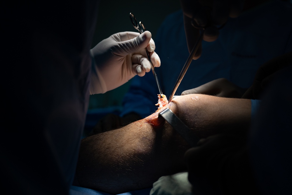 HEART 22 Orthopedic Team Conduct Life Changing Operations For Local Guatemalan Citizens