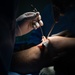 HEART 22 Orthopedic Team Conduct Life Changing Operations For Local Guatemalan Citizens