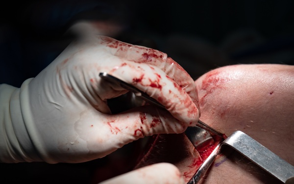 HEART 22 Orthopedic Team Conduct Life Changing Operations For Local Guatemalan Citizens