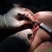 HEART 22 Orthopedic Team Conduct Life Changing Operations For Local Guatemalan Citizens