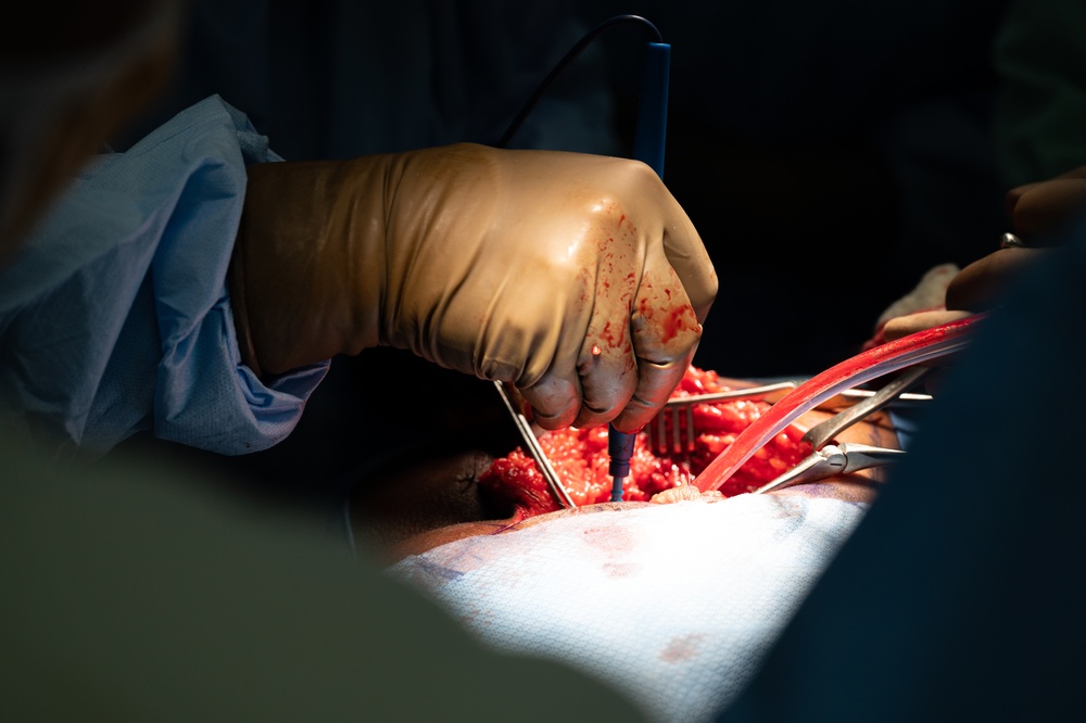 HEART 22 Orthopedic Team Conduct Life Changing Operations For Local Guatemalan Citizens