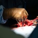 HEART 22 Orthopedic Team Conduct Life Changing Operations For Local Guatemalan Citizens