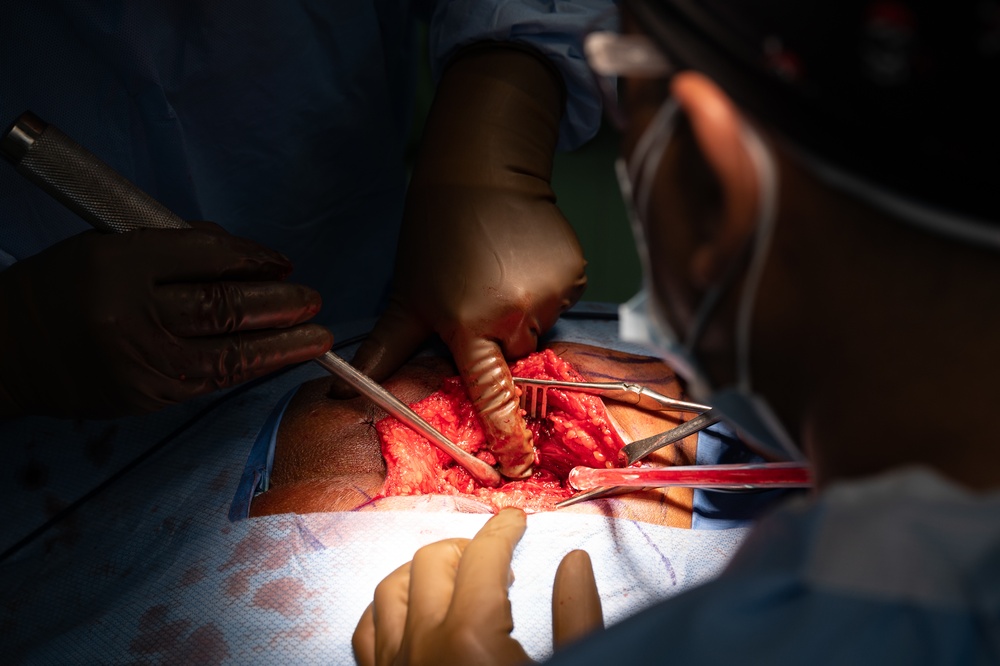 HEART 22 Orthopedic Team Conduct Life Changing Operations For Local Guatemalan Citizens