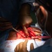 HEART 22 Orthopedic Team Conduct Life Changing Operations For Local Guatemalan Citizens