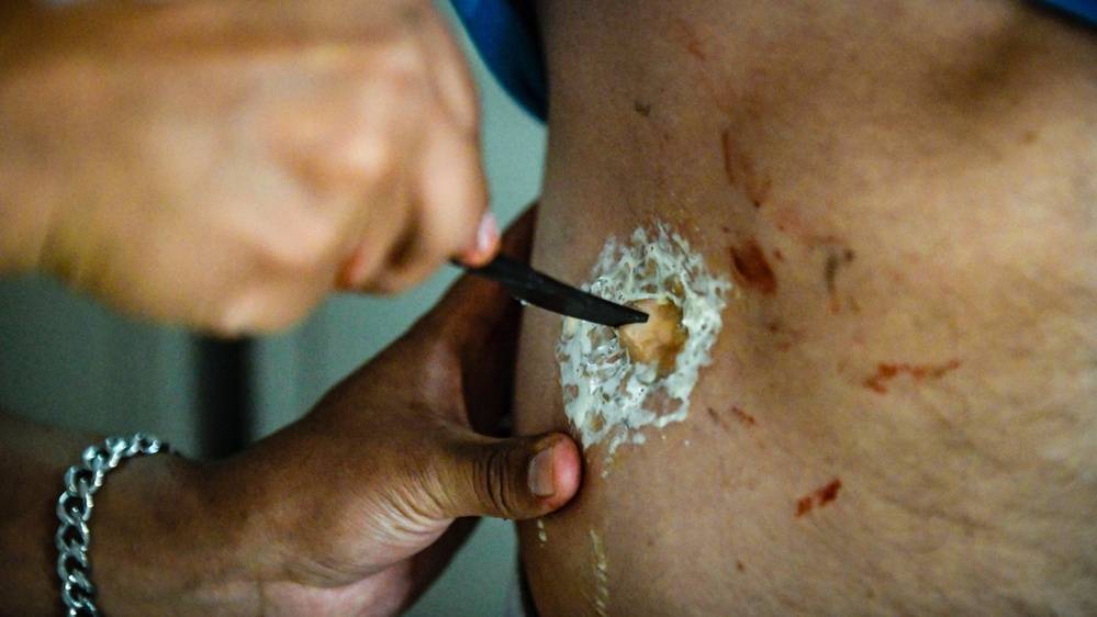 The bloody reality of casualty care
