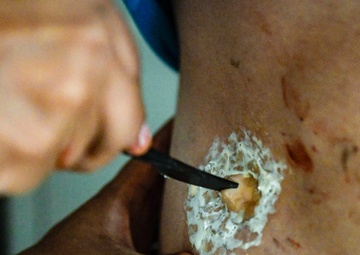 The bloody reality of casualty care
