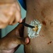 The bloody reality of casualty care