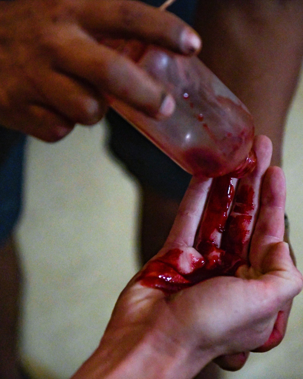The bloody reality of casualty care