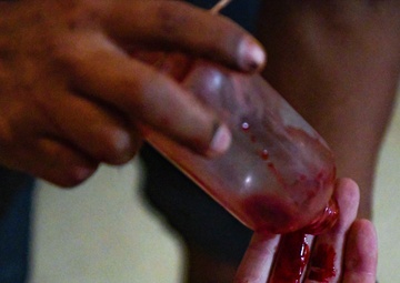 The bloody reality of casualty care