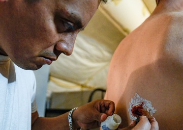 The bloody reality of casualty care