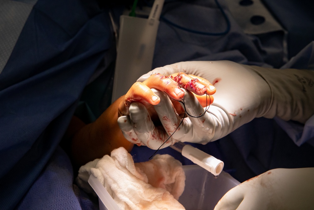 USNS Comfort Medical Team Performs Surgery for Continuing Promise 2022