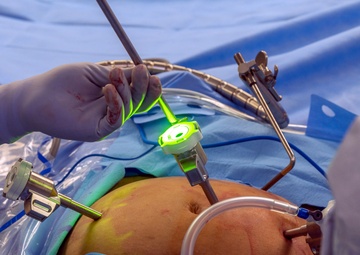 Eisenhower Army Medical Center, surgery, robotic, DaVinci