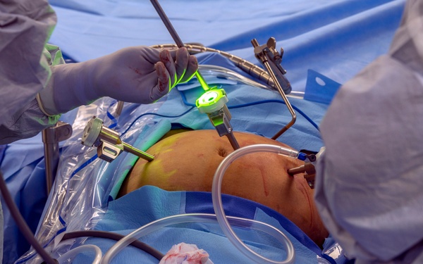 Eisenhower Army Medical Center, surgery, robotic, DaVinci