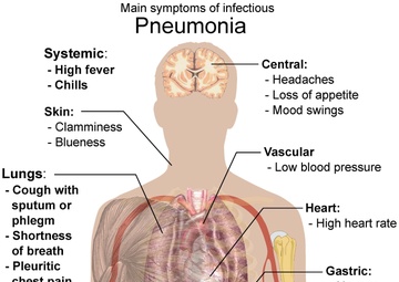 World Pneumonia Day Focuses on Awareness, Prevention