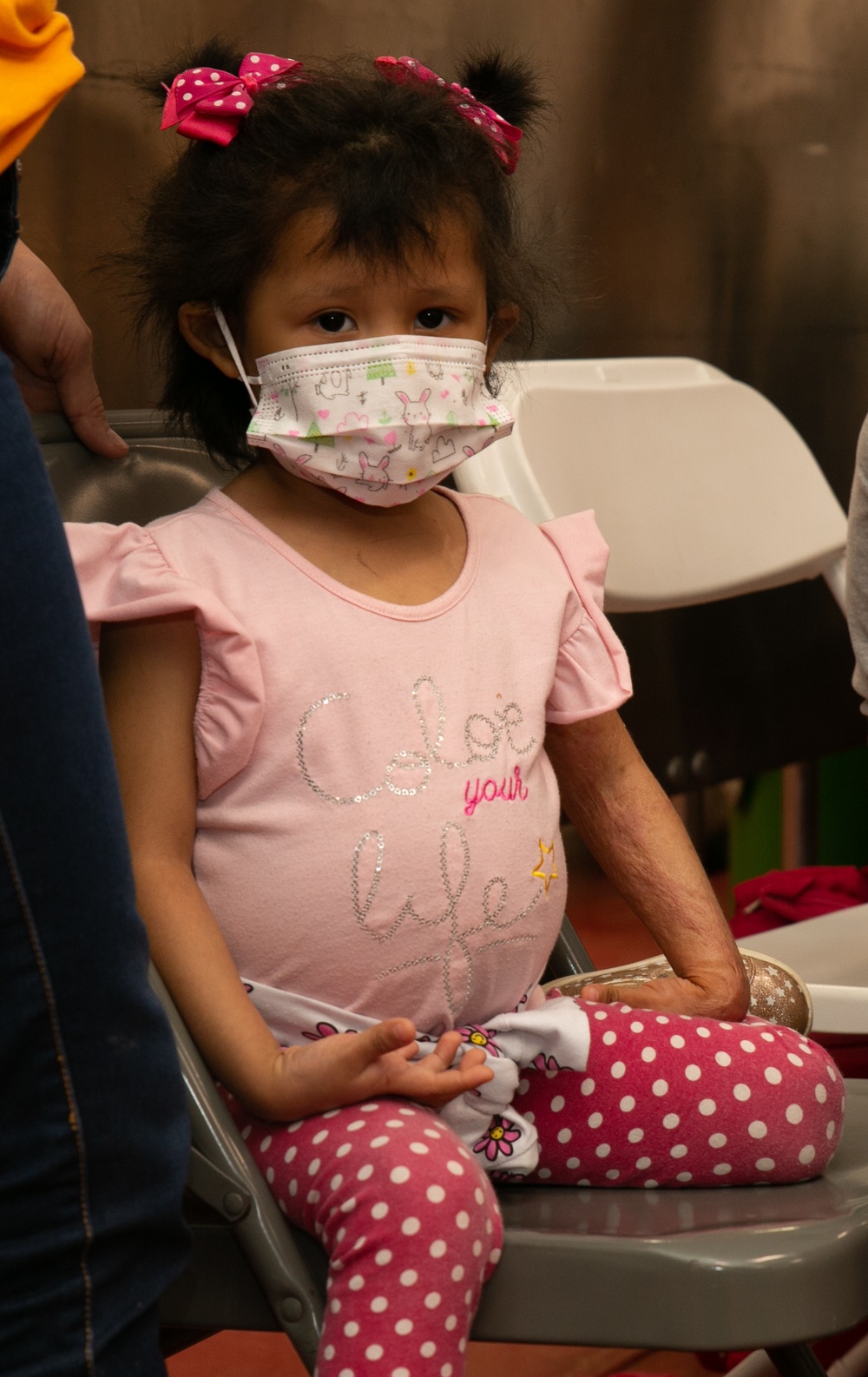 YOUNG COLOMBIAN PATIENT RECEIVES SCAR-REVISION SURGERY ABOARD USNS COMFORT