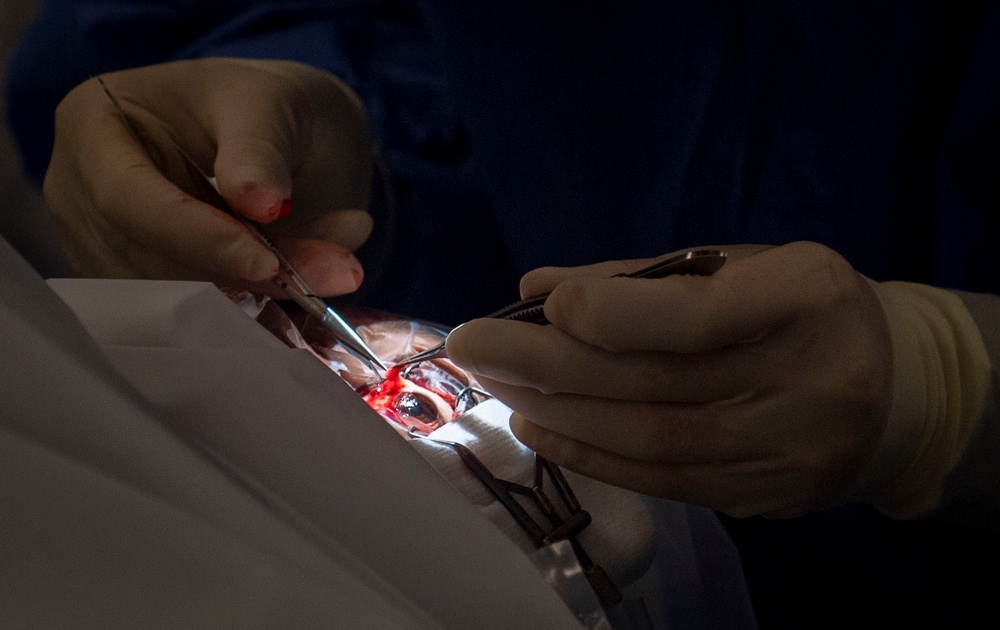 Pterygium Eye Surgery in Santo Domingo for CP22