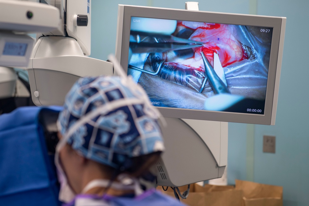 Pterygium Eye Surgery in Santo Domingo for CP22