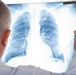 Lung Cancer Summit Highlights the Importance of Early Screening