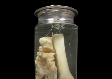 Bone and Joint Health